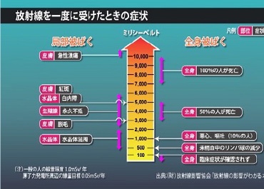 放射線を一度に受けたときの症状